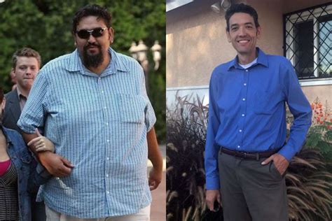 Neils Story Gastric Sleeve Ucla Health