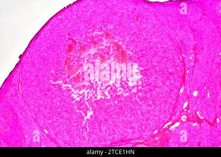 Ovary Section Showing Corpus Luteum Stroma Epithelium And Follicles