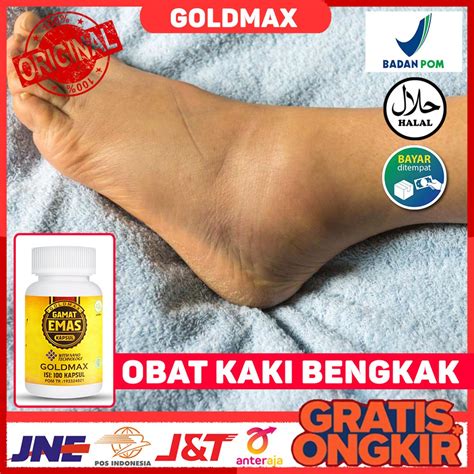 Jual Obat Kaki Bengkak Pembengkakan Pada Kaki Kaki Terkilir Sendi