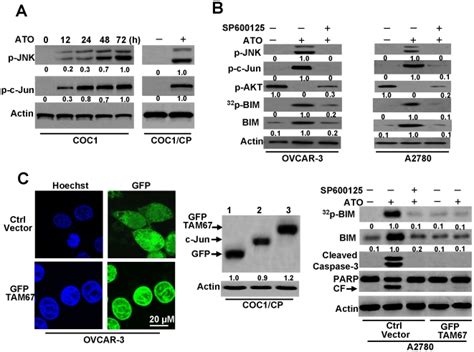 A Detection Of P JNK And P C Jun In Cells COC1 Cells Were Treated