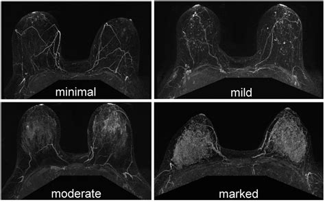 Examples From The Breast Imaging Reporting And Data System Bi Rads