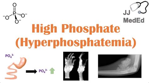 High Phosphate (Phosphorus): Causes, Effects Ways To, 43% OFF