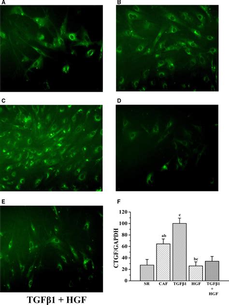 Ae Immunofluorescence Assay Results Demonstrating Connective Tissue