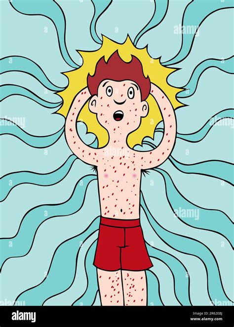 Caricatura De Un Hombre Que Está Estresado Y Desarrolla La Urticaria Imagen Vector De Stock Alamy