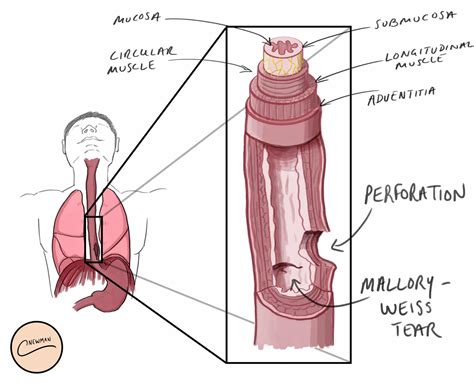 Esophagus Layers