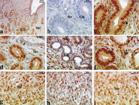 Immunohisto chemical localization of ER α in endometrium of control