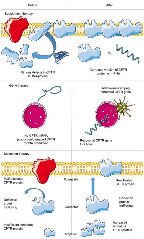 Gene Therapy Cystic Fibrosis