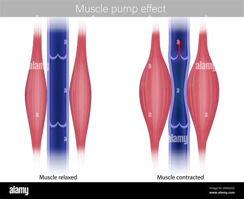 Effet De La Pompe Du Muscle Squelettique Illustration De L Effet De La