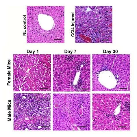 Comparison Of Liver Histology Between The Control Liver Failure Model