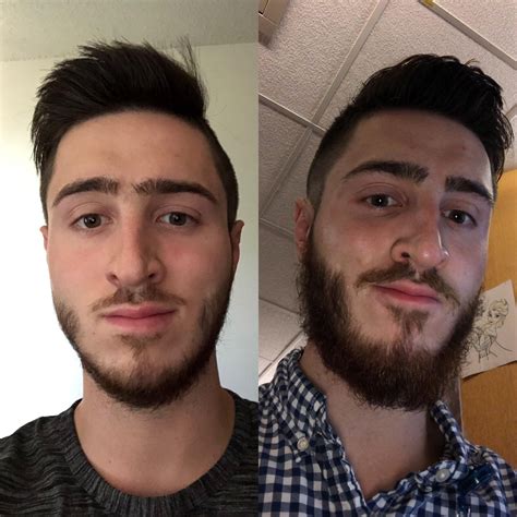 1 Year Patchy Beard Growth | Beard on Brother