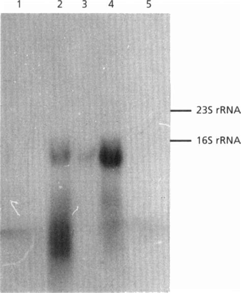 Northern Blot Hybridization Analysis Of The Gap Transcript Total Rna