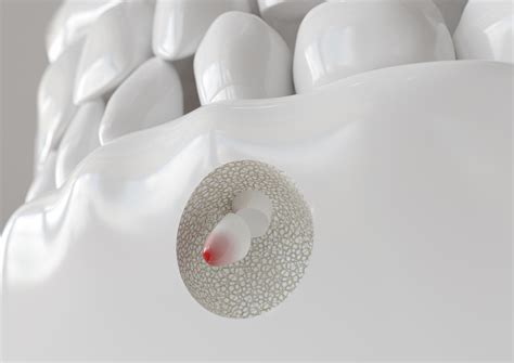 El Paso Dentist Uses A Root Canal To Save Infected Teeth | El Paso, TX