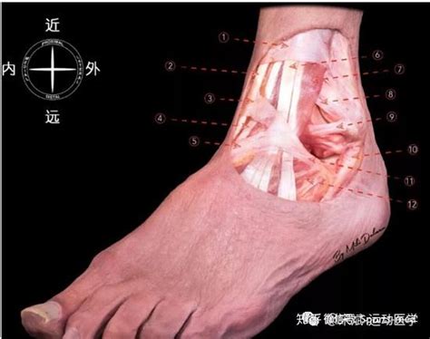 关节镜下伸肌下支持带增强联合broström技术治疗踝关节陈旧性不稳 知乎