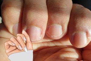 Comment se débarrasser des petites peaux autours des ongles