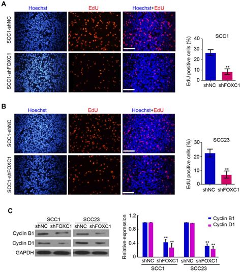 Silencing Foxc Inhibits Growth And Migration Of Human Oral Squamous