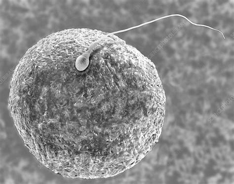 Sperm Cell Under Electron Microscope