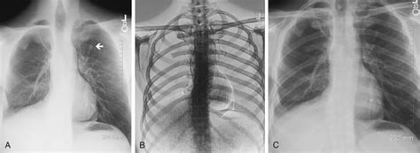 Describe How To Acquire Radiographic Images Using Various Techniques Leblanctrust