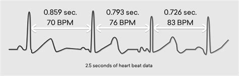 Heartmath Science Heartmath Institute