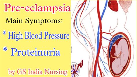 Pre Eclampsia Pre Eclampsia Definition Causes And Symptoms Diagnosis And Complications