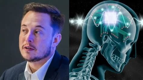 Exclusivo Elon Musk Quebra O Sil Ncio Sobre O Implate De Chip Cerebral