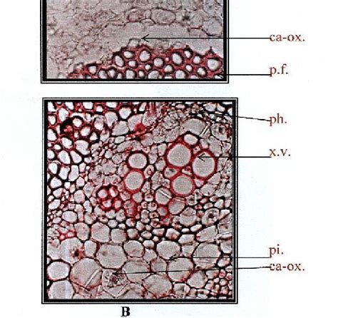 A) Photo of T.S. of the rachis x 100 B) Photo of detailed T.S. of the ...