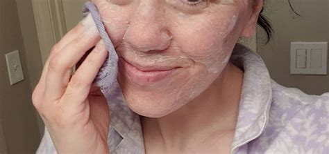 Incredible tips to get rid of dry patches on face