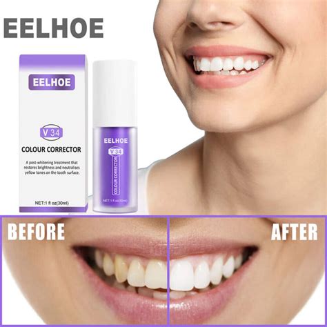 Best Choice Eelhoe V34 30ml Teeth Whitening Color Corrector Stain