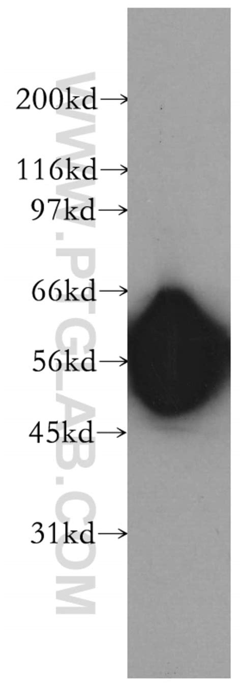 Enpp6 Rabbit Anti Human Mouse Rat Polyclonal Proteintech 150 μl