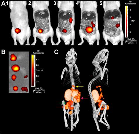 Multimodal Fluorescence And μspectct Imaging Of Intraperitoneal