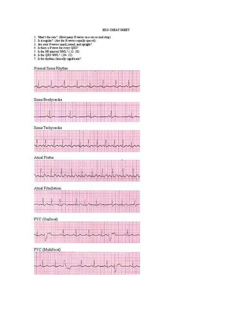 Ekg Cheat Sheet Pdf