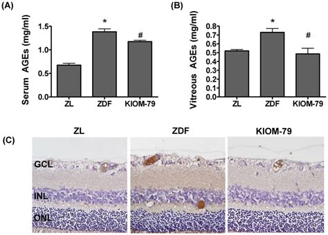 Effect Of Kiom On The Formation Of Advanced Glycation End Products