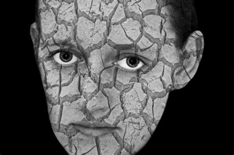 cracked skin  stock photo public domain pictures
