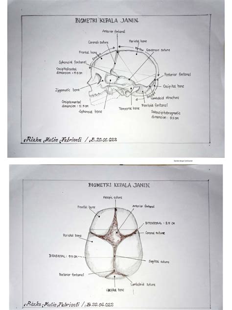 Biometri Kepala Janin And Anatomi Panggul 1 Pdf