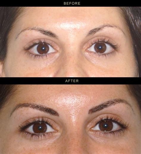 Permanent Eye Makeup Before And After Saubhaya Makeup