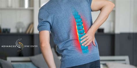 Lumbar Revision Surgery In Mckinney Tx Advanced Spine Center