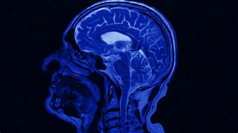 Pituitary adenoma treatments: Surgery, medication, radiation