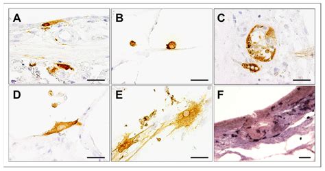 Cell Tropism In Canine Distemper Virus Cdv Infected Canine