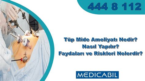 Blog Tüp Mide Ameliyatı Gastrektomi Nedir Nasıl Yapılır Faydaları