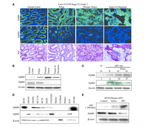 Regulation Of EphB4 And EphB2 Expression By APC Samples Of Colon