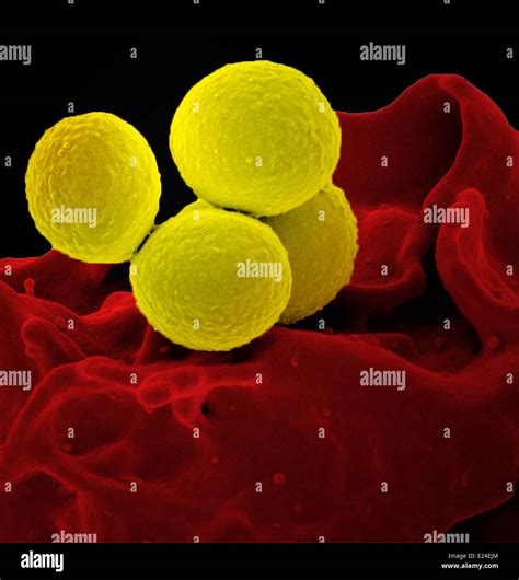 Scanning Electron Micrograph Of A Human Neutrophil Ingesting Mrsa Stock