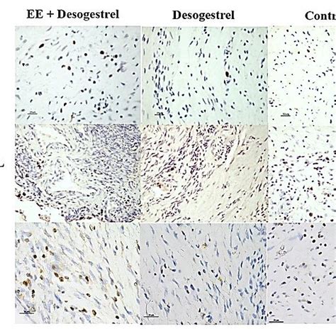 Representative Photomicrograph Of Immunohistochemical Resections For KI