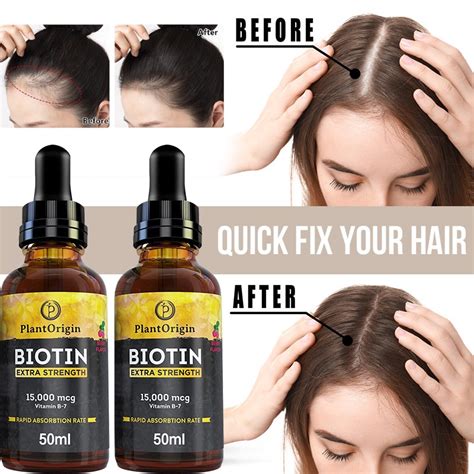 Quick Hair Growth Essential Oil Anti Hair Loss Treatment Quick Hair Growth Essence To Prevent