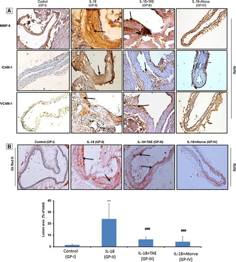 Immunohistochemical Analysis And Quantification Of Atherosclerotic