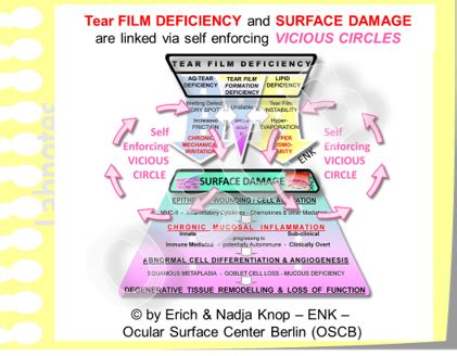 Overview On Dry Eye Disease Ocular Surface Center Berlin