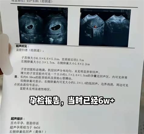 還沒畢業就當渣男？武漢大學生趁女友懷孕期間出軌，學校嚴重警告 每日頭條