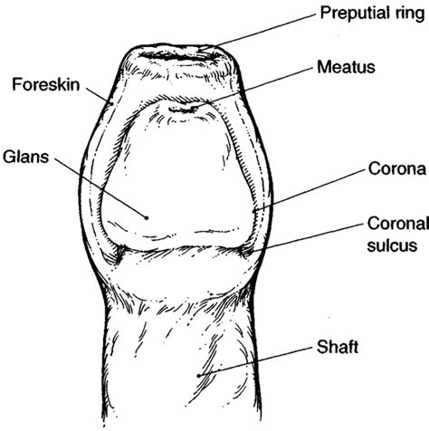 Circumcision Obgyn Key