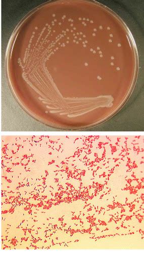 Haemophilus Influenzae Listeria Monocytogenes Flashcards Quizlet