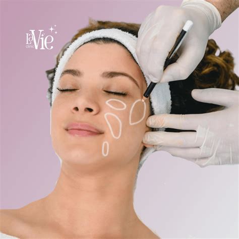 Profhilo Ha Skin Boosters N And R Lavie Clinic