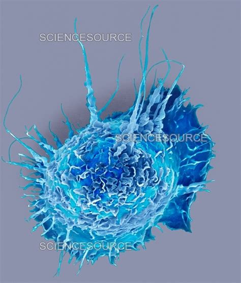 Alveolar Macrophage Sem Stock Image Science Source Images