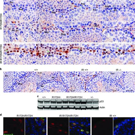 P53 Transcripts In P53 And P53 R172hr172h Mice Testes A P53 Download Scientific Diagram